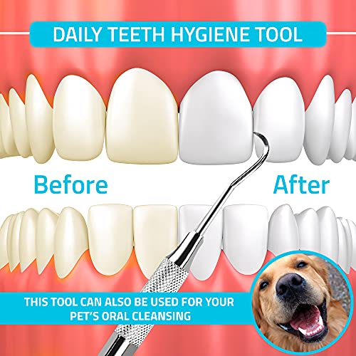 Utopia Care - Professional Dental Tartar Scraper Tool - Dental Pick, Double E...