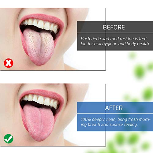 Premium Tongue Scraper Cleaner, BPA Free Tongue Scrapers, Healthy Oral Care, ...