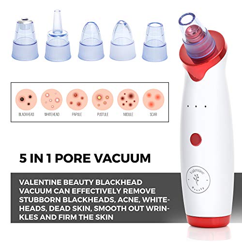 Valentine Beauty Blackhead Remover Pore Vacuum - Cleaner Rechargeable Pore Ex...