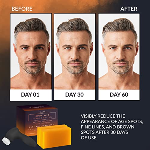 Valitic Skin Lightening Kit - Facial & Body Cleansing Brush and Kojic Acid So...