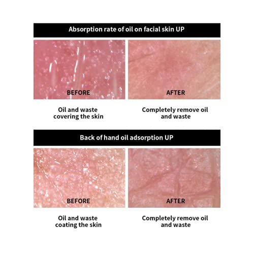 Vall Oil-Absorbing Volcanic Face Roller, Made In Korea (Black)