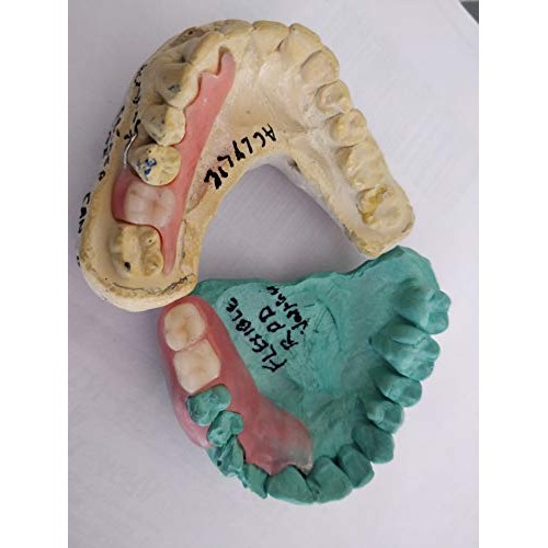 Affordable Flexible Valplast Customized Partial Denture (Pink, Valplast)