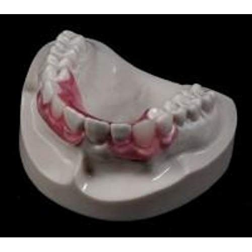 Affordable Flexible Valplast Customized Partial Denture (Pink, Valplast)