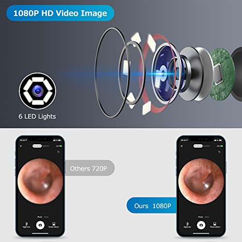 Ear Wax Removal, Ear Cleaner Camera 1080P, Ear Wax Removal Tool with 6 LED Li...