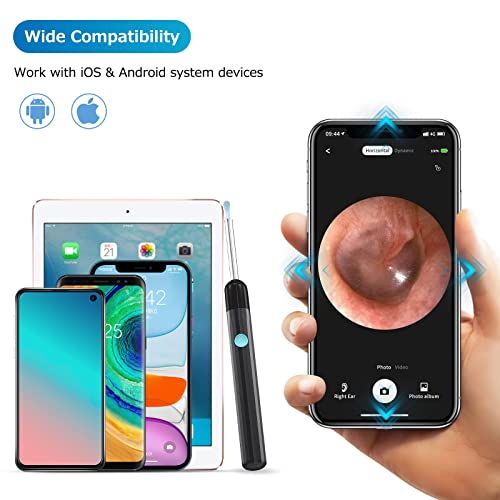 Ear Wax Removal, Ear Cleaner Camera 1080P, Ear Wax Removal Tool with 6 LED Li...