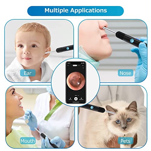 Ear Wax Removal, Ear Cleaner Camera 1080P, Ear Wax Removal Tool with 6 LED Li...