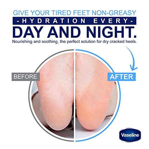Vaseline Deep Moisture Foot Cream For Dry Cracked Feet & Heel, Non-Greasy Cra...