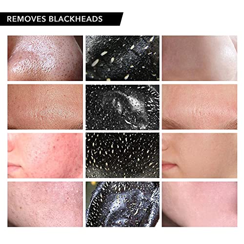 Vassoul Blackhead Remover Mask, Peel Off Blackhead Mask, Black Mask - Deep Cl...