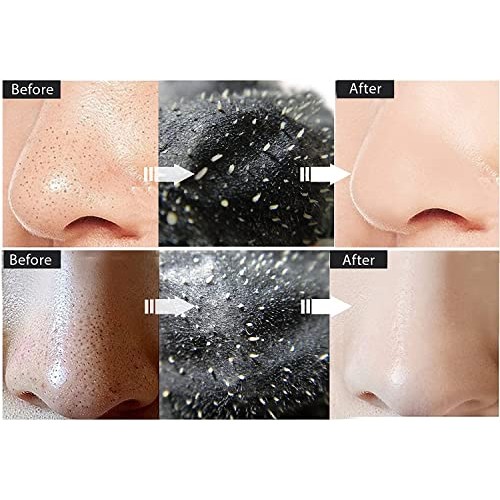 Vassoul Blackhead Remover Mask, Peel Off Blackhead Mask, Black Mask - Deep Cl...