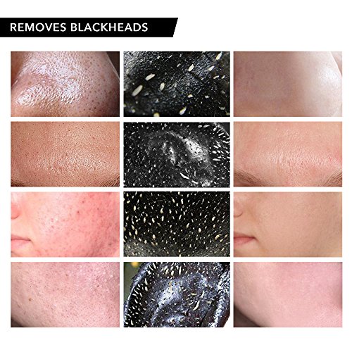 Vassoul Blackhead Remover Mask, Peel Off Blackhead Mask - Deep Cleansing Blac...