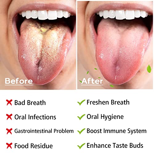 Tongue Scraper Cleaner for Adults and Kids - VEGOPET Double-Sided Super Soft ...