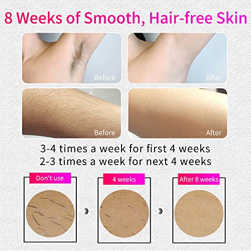 VEME IPL Hair Removal for Women Permanent, at-Home Hair Removal Device Painle...