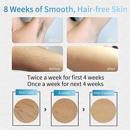 VEME IPL Laser Hair Removal for Women Permanent，at-Home Hair Removal Device ...