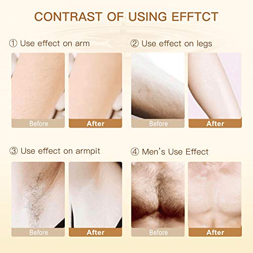 Hair Inhibitor 50ml Upgraded, Hair Stop Growth Spray, Non-Irritating Hair Rem...