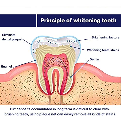 Venus Visage Teeth Whitening Pen(2 Pens), 20+ Uses, Effective＆Painless, No S...