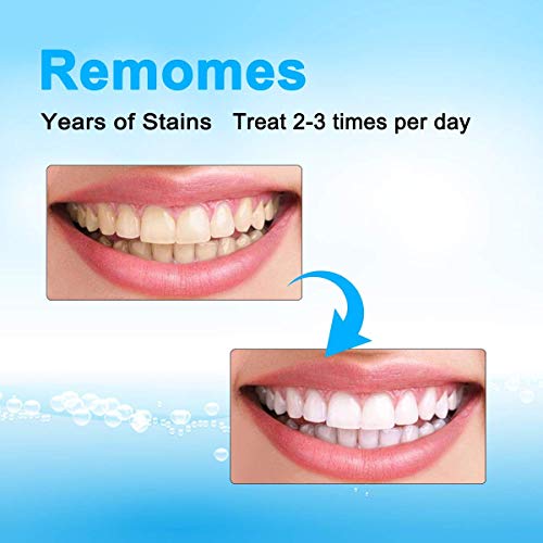 Venus Visage Teeth Whitening Pen(2 Pens), 20+ Uses, Effective＆Painless, No S...