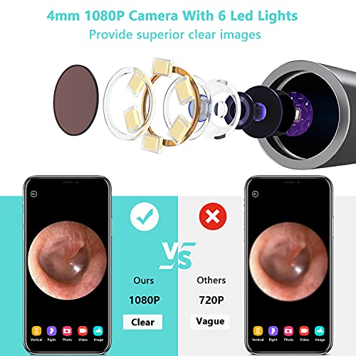 Viajero C3 Ear Wax Removal Cleaner Tool, 2021 Latest Upgraded Earwax Remover ...