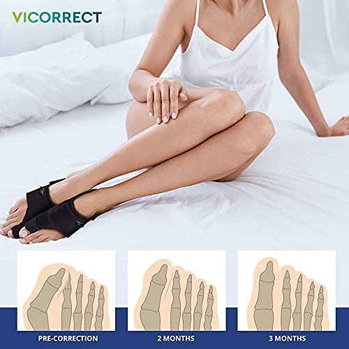 Vicorrect Bunion Corrector & Bunion Toe Separators, Orthopedic Bunion Splint ...