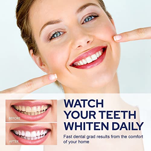 VieBeauti Teeth Whitening Kit - 5X LED Light Tooth Whitener with 35% Carbamid...
