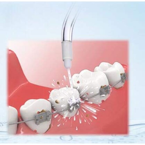 VINFANY Replacement Dental Water Jet Orthodontic Tips for Waterpik Oral Irrig...