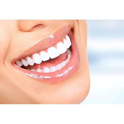 VINFANY Replacement Dental Water Jet Orthodontic Tips for Waterpik Oral Irrig...