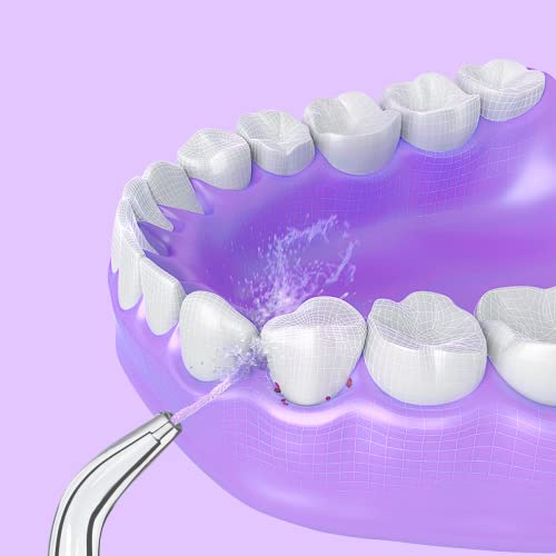 VINFANY Replacement Jet Tips for Dental Water Oral Irrigator Wp-100 Wp-100W W...