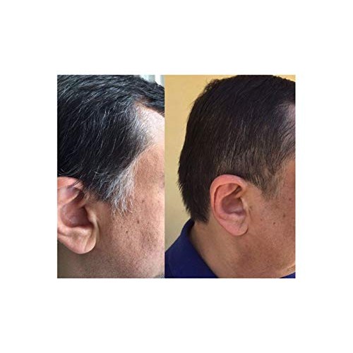 Anti Gray Hair Supplements The Best - Gray Hair Reverse Complex - Natural Sol...