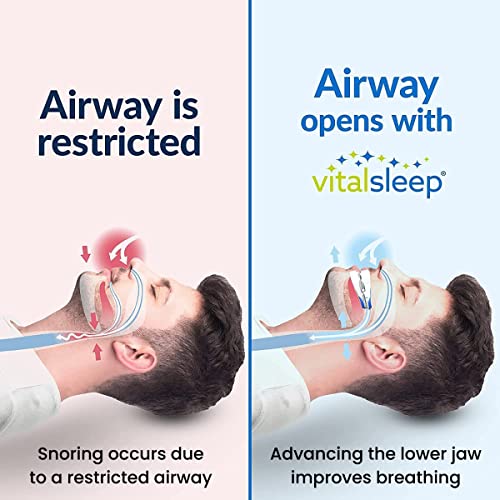 VitalSleep Anti-Snoring Mouthpiece, Adjustable Jaw Positioning, Custom Teeth ...