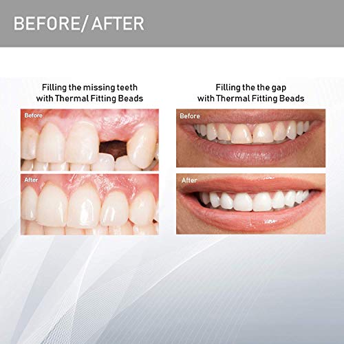 Teeth Repair Kit, Temporary Teeth replacement kit, Moldable False Teeth, Ther...