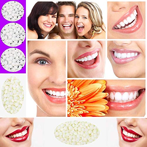 Teeth Repair Kit, Temporary Teeth replacement kit, Moldable False Teeth, Ther...