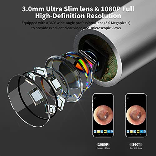 VIVP Ear Wax Removal with Camera, Wireless Otoscope with 6 LED Light, 1080P F...