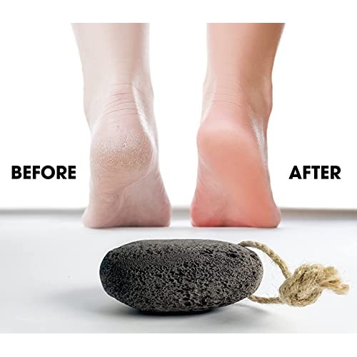 Foot Pumice Stone by VNI Stone - Natural Earth Lava Pumice Stone for Feet cal...
