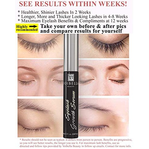 Voibella Eyelash Growth Serum and Eyebrow Enhancer 8.87ML - Best Natural Eye ...