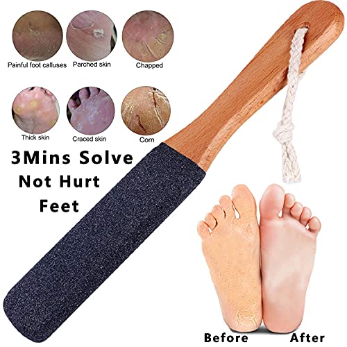 Vridale Pumice Stones for Feet Lava Pumice Stone Foot File Callus Removal Foo...