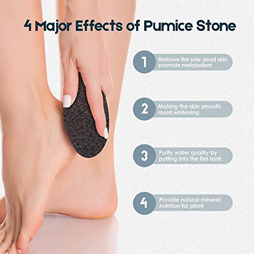 Vridale Pumice Stones for Feet Lava Pumice Stone Foot File Callus Removal Foo...