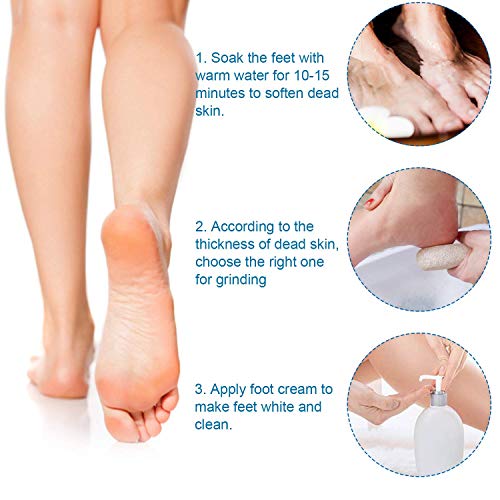 Vridale Pumice Stones for Feet Lava Pumice Stone Foot File Callus Removal Foo...