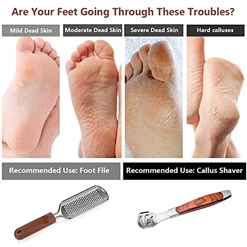Colossal Foot Rasp & Wood Handle Callus Shaver (10 Replacement & 1 Foot File ...