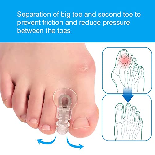 Gel Toe Separator for Overlapping Toes,Bunion Corrector for Big Toe,Hammer To...