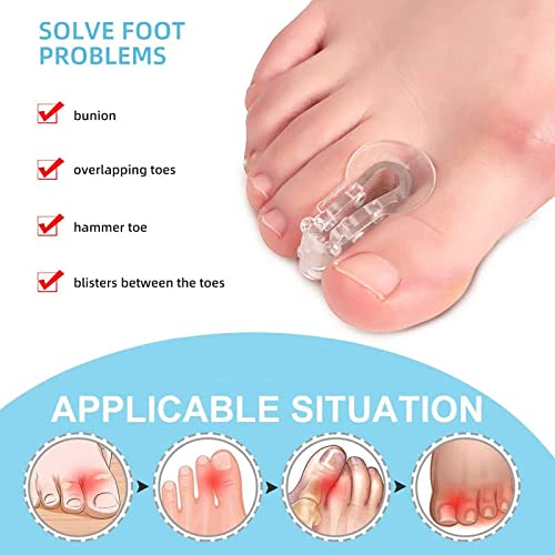 Gel Toe Separator for Overlapping Toes,Bunion Corrector for Big Toe,Hammer To...