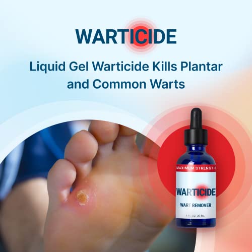 WARTICIDE Fast-Acting Wart Remover - Plantar and Genital Wart Treatment, Atta...