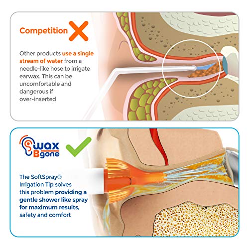 WaxBgone Ear Wax Removal Kit with SoftSpray Ear Irrigation Tips for Safe and ...