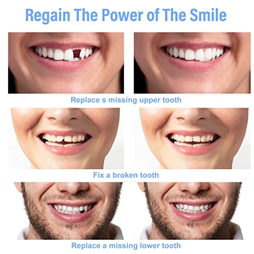 Temporary Tooth Repair Kit, Natural Shade Fake Teeth Filling The Gap, Tempora...