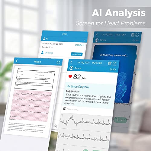 Wellue BP2 Connect - Blood Pressure Monitor + AI-ECG | Wi-Fi & Bluetooth Sync...