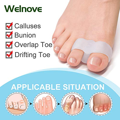 Welnove Pack of 12 Bunion Corrector, Toe Separators with 2 Loops, Big Toe Spa...