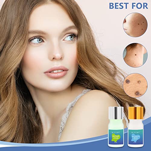 Skin Tag Remover, Mole Remover, Effectively Remove Moles & Skin Tags without ...