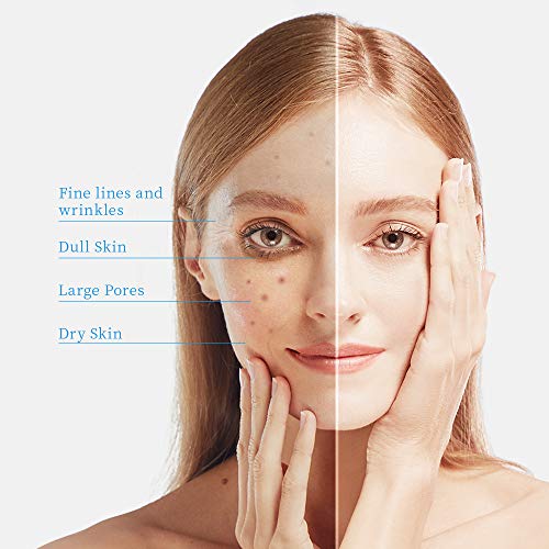 WIS Moisturizing 4-Piece Skin Care Set with Facial Cleanser, Toner, Lotion, C...