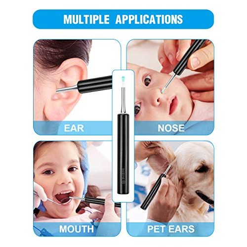 Wiscky BEBIRD Ear Wax Removal Tool Endoscope-Professional Ear Cleaner Camera ...