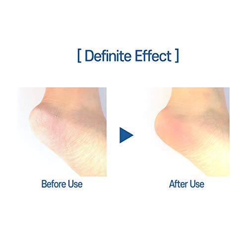 WITHSHYAN Korean Professional Foot File - Double-Sided Callus Remover, Feet S...