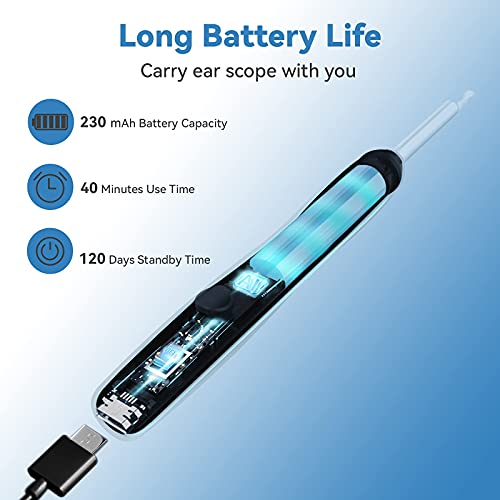 Ear Wax Removal Tool Camera, Earwax Remover Tool, Ear Camera,1600P FHD Wirele...