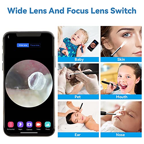 Ear Wax Removal Tool Camera, Earwax Remover Tool, Ear Camera,1600P FHD Wirele...